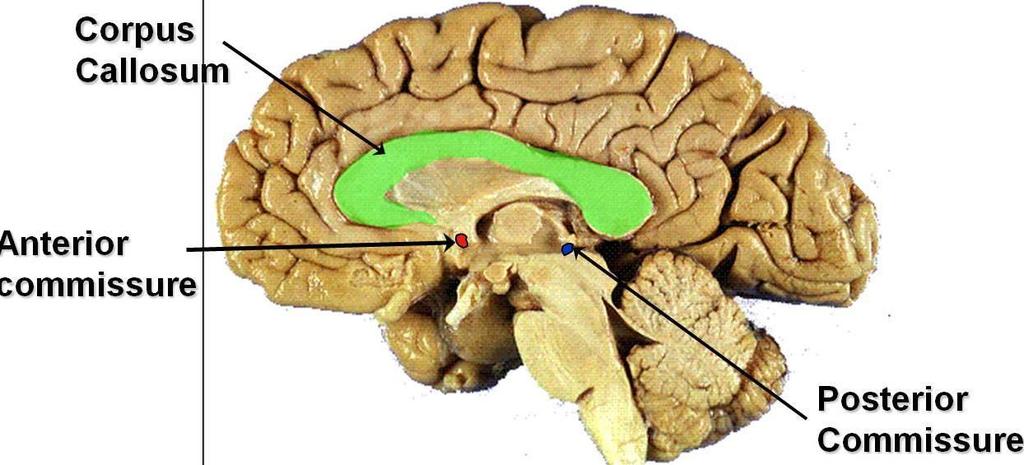 (anteriorposterior) büyür.