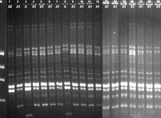 Yo un Bak m Ünitesinde Yatan Hastalar n drarlar ndan zole Edilen Candida Türlerinin Moleküler Epidemiyolojisi ve Antifungal Duyarl l klar Resim 2. C.glabrata suşlarının Cnd3 primeri ile elde edilen RAPD paternleri.