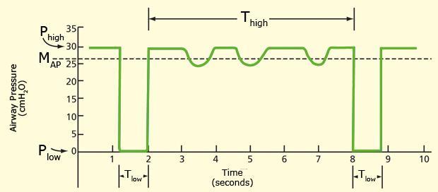 APRV- Havayolu Basınç Salınımlı Ventilasyon Basınç kontrollü - aralıklı zorunlu ventilasyon Zaman