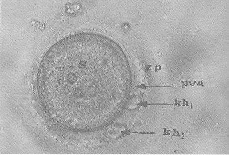 (a) Olgun (MII) oositin mikrografýdýr. Germinal vezikül yýkýlmýþtýr. 1. kutup hücresi (KH1) net olarak seçilmektedir.