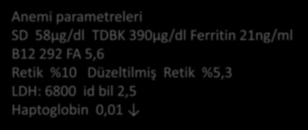 388,000/mm 3 Anemi parametreleri SD 58µg/dl TDBK 390µg/dl Ferritin 21ng/ml B12 292 FA 5,6 Retik %10