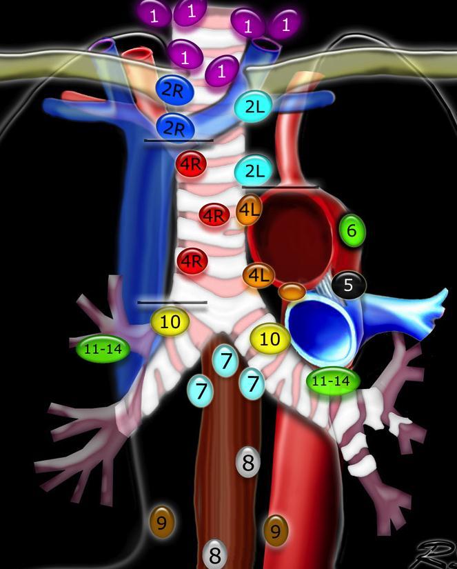 Minimal invaziv yontemler: Bronkoskopi EBUS + EUS