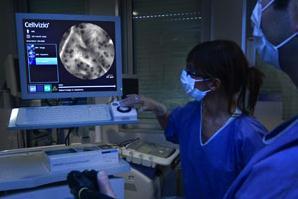 Yeni Gelismeler: Endomikroskopi Confocal laser teknolojisi ile