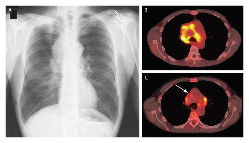 SVK - Tanı Anatomik lokalizasyon Vasküler özellikler