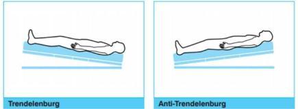 Supine (Sırtüstü) Pozisyon Anestezi indüksiyonunda hastalar ilk etapta supine pozisyonda anestetize edilirler.