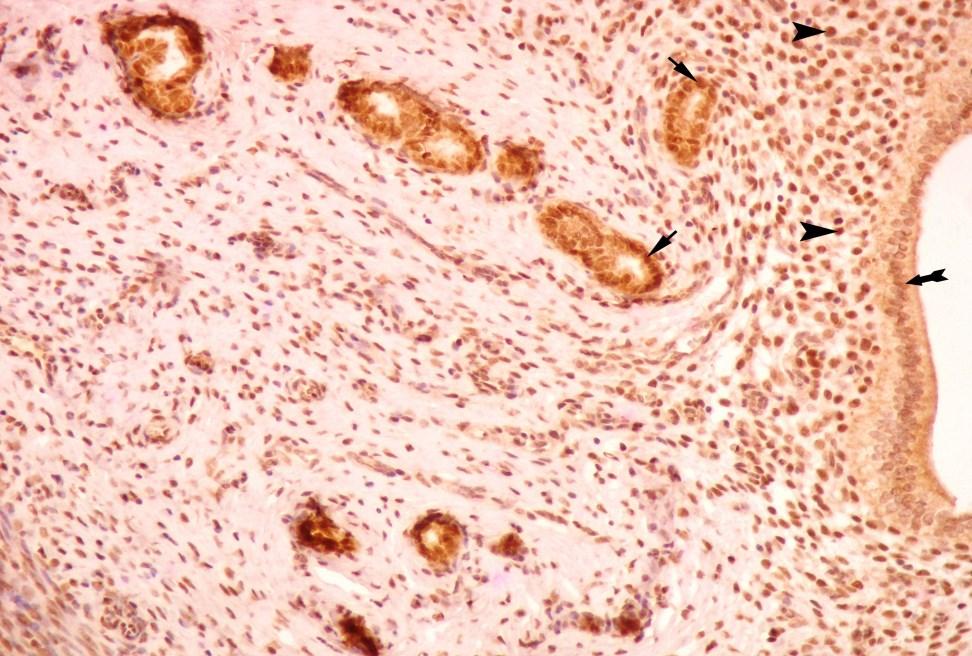 Şekil 20. Metöstrus hipertiroidili grupta, uterus dokusunda ERα immünohistokimyasal boyama, 200X.