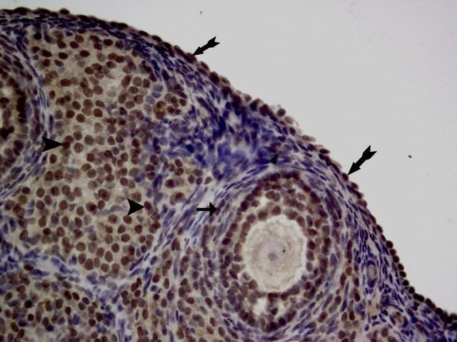 Germinal epitel hücrelerinde ERα pozitif boyanma (kalın ok), ganüloza hücrelerinde ERα pozitif boyanma (ince ok), korpus luteum hücrelerinde ERα pozitif boyanma (ok başı). Şekil 23.