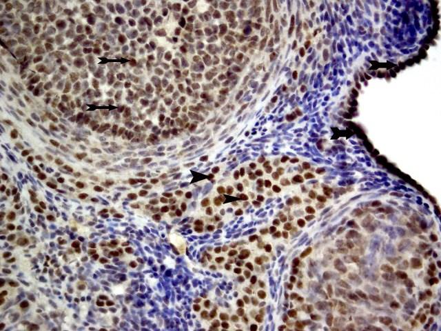 Diöstrus hipertiroidili grupta, ovaryum dokusunda ERα immünohistokimyasal boyama, 400X.
