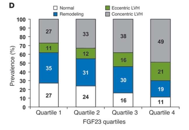 Yüksek FGF23=> Daha çok sol ventrikül hipertrofisi, Daha az kardiyak