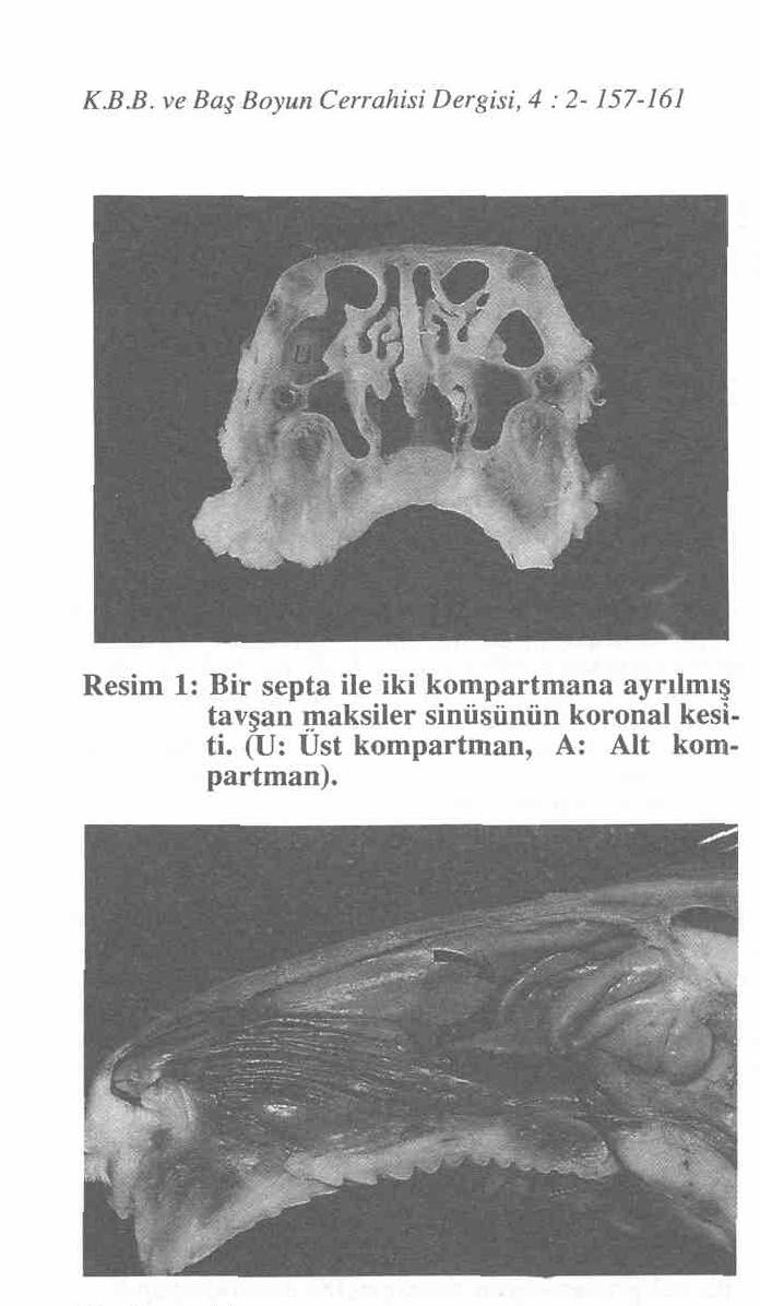 Dr. Fikret İleri ve ark. Resim 2: Tavşan maksiller sinüs ostiumunun burun lateral duvarına açılışı (Okla işaretli).