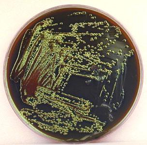 Bu besiyeri, gram pozitif bakterilerin gelişimini baskılar. Yaygın olarak E.coli ayırımında kullanılır. E.coli menekşe ve metalik görünür.