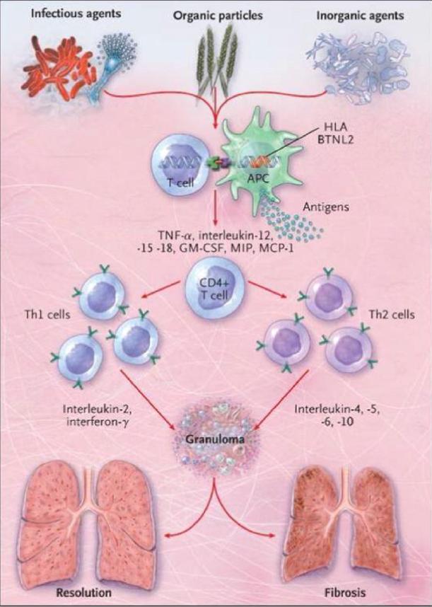 Sah BP, Goyal S, Ianuzzi M