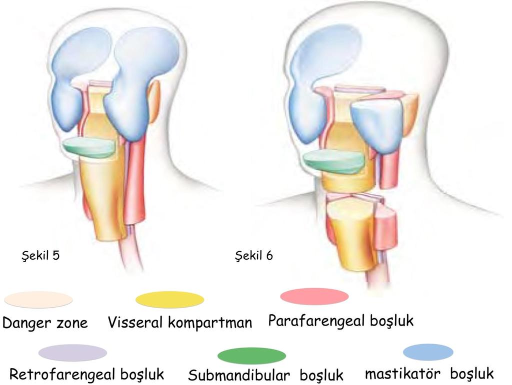 ParafarengealApse Lateral farengeal (diğer adları ile parafarengeal, farengomaksiller) boşlukta gelişen apsedir.