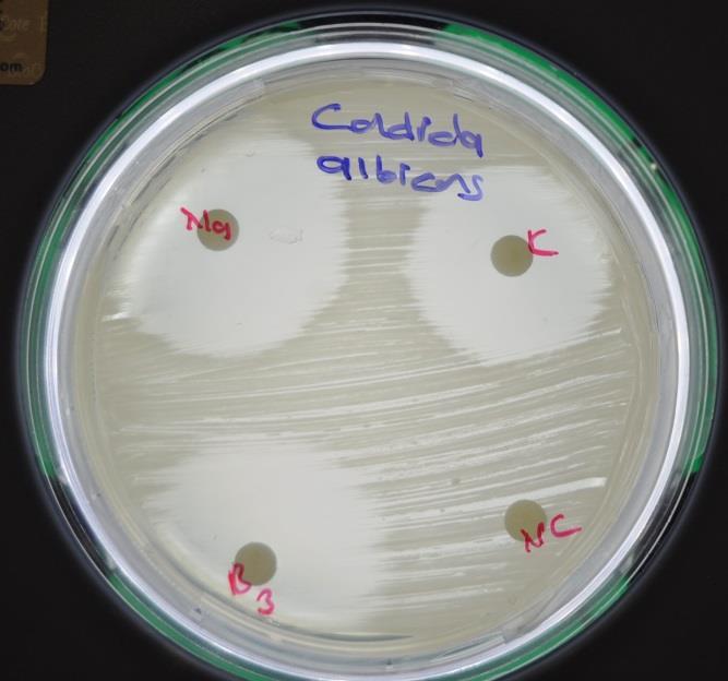 (100μl) Nutrient Agar (NA), 10 6 cfu/ml