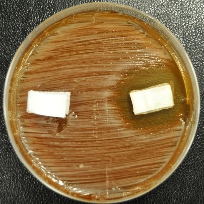 Escherichia coli