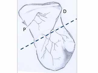 Anatomi Skafoid kemiğin %75 i eklem kıkırdağı ile kaplıdır. Kan akımı (Şekil 11): Şekil 11. Skafoid kemiğin kanlanması. P: Radial arterin palmar dalı. D: Radial arterin dorsal retrograd dalı.