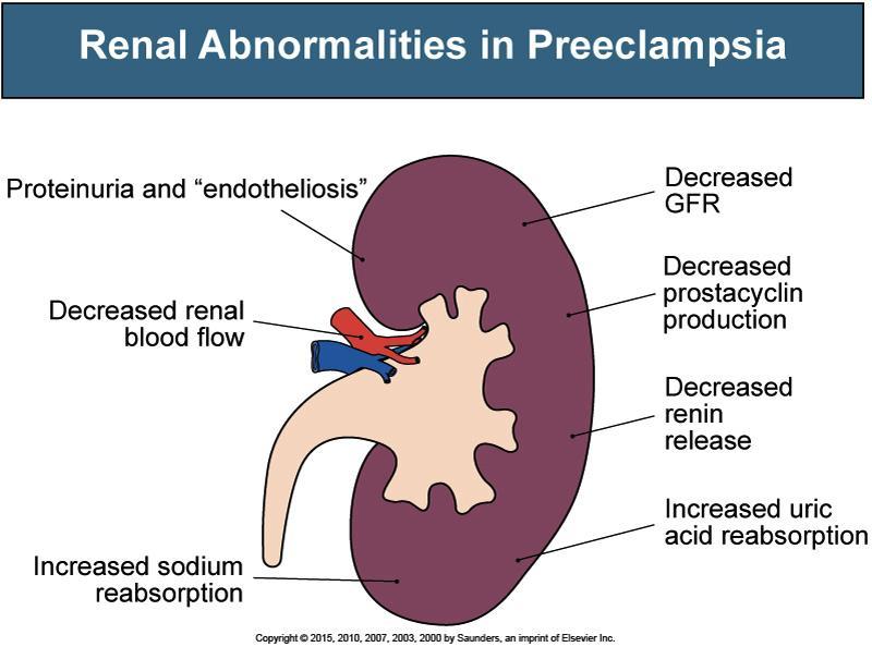 Pre-eklampsi'de Renal Anomaliler Proteinüri ve endotheliosis Azalmış renal kan akımı Azalmış GFR