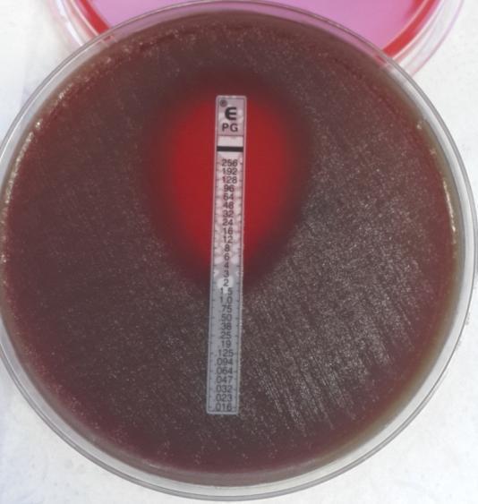 Olgu 2 Antibiyogramla ilgili yorumlardan hangisi doğrudur?