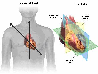 Şekil 2.1.2 Ekokardiyografik görüntülemede kullanılan sagittal, koronal ve transvers kesitler.