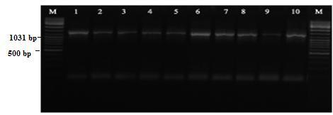 38 Şekil 3.2.1.RFLP-PCR bulguları (16S rdna kesim yapılmamış).