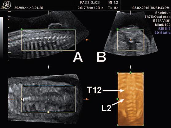 İşlevsel prenatal değerlendirme