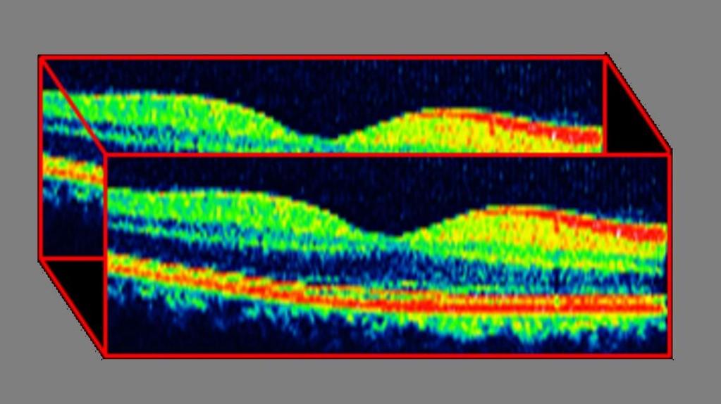 yerleşimde Multiple B-scan