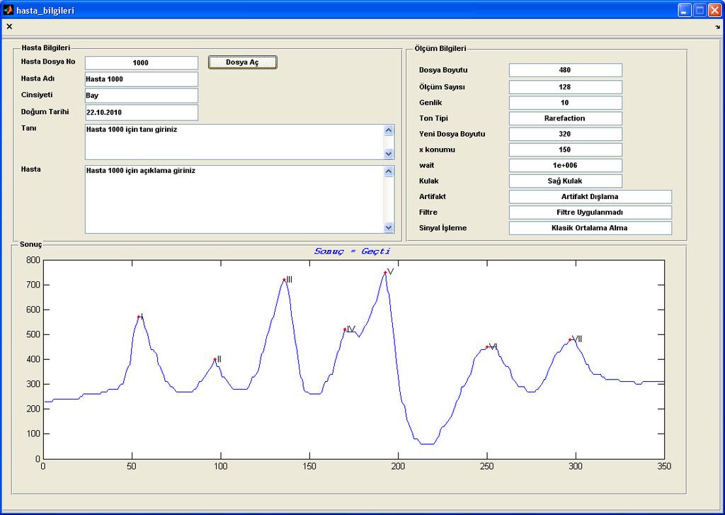 107 Şekil 4.39. Kayıtlı hasta bilgi ekranı 4.6.2. Otomatik değerlendirme Otomatik dalga tanımlaması sırasında, DSP ile V.