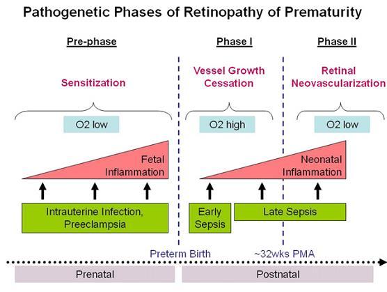 Enfeksiyon ve inflamasyon Prenatal, perinatal ve sistemik inflamasyon ve enfeksiyonlar immatür retinayı ROP a duyarlı