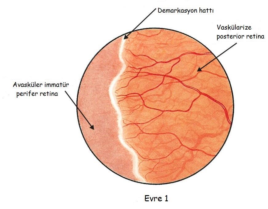 evreye ayrılır EVRE 1 Vasküler ve