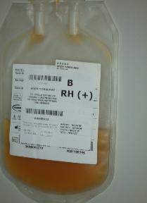 Elde edilen havuz trombositin üzerine, birleştirilen random trombositlerin uygunluk etiketi (hazırlandığı kan merkezi, bağış tarihi, ünite