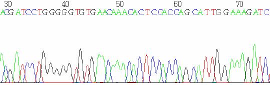 Hasta Kodu Değişim Normal Dizi Kromatogram CGATCC TG GGG GGTGTGAACA AACACTCC ACCA GC ATT GGAAAGA 59 35delG/35delG Normal Dizi ACGATCCTG GGG GGTGTGAACA AACACTCC ACCA GC ATT GGAAAGA