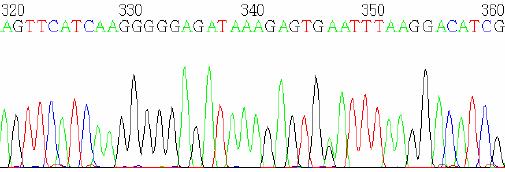 Hasta Kodu Değişim Normal Dizi Kromatogram AAGATC TGGC TCACCG TCC TC TTCA TT T TTCGCATT AT G ATC S130 G79A/+ Normal Dizi AGTTC AT CAAGGGGGAGATAAAGAGT GAATTT AAGGACATCG