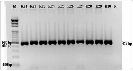 1.3.4 Mitokondriyal Genomda A7445G Değişiminin Saptanması İçin İlgili Bölgenin PCR Amplifikasyonu ve Ürününün Saptanması Seksensekiz bireyden