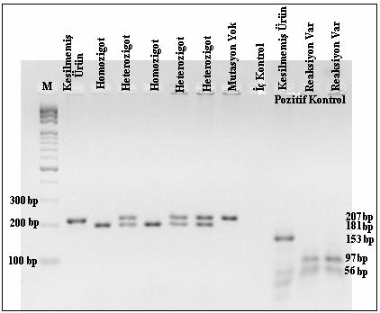 3.1.5 Restriksiyon Enzim Kesimi ve Sonuçların Değerlendirilmesi Probandların DNA dizi analizlerinde 35delG değişimi olan olgular için diğer aile bireylerinde PCR amplifikasyonları yapıla rak enzim