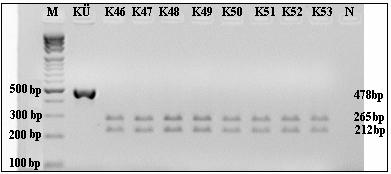 nükleotidi içeren PCR ürününün enzim kesimi yapıldı. Enzim yabanıl tip ürünleri kesmektedir. Mutasyon varlığında kesim gerçekleşmemektedir. Hiçbir olguda A74445G mutasyonu saptanmadı.