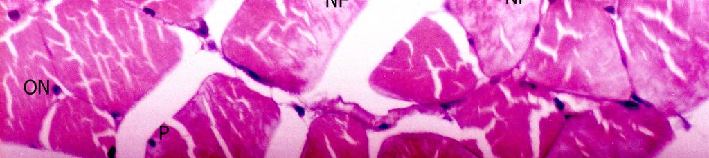 Resim 6: D9 Grubu, 15 gün boyunca 1 mg/kg Atorvastatin verilen ratların quadriceps femoris kasının ışık mikroskobik görünümü; kas liflerinde nekroz görülürken, nükleuslarda ovalleşme ve piknoziz.