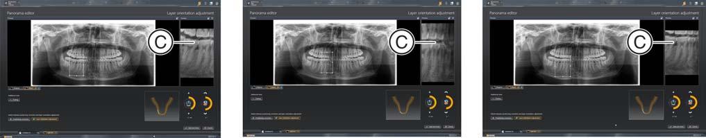 3 Panoramaeditor'ü kumanda edin Sirona Dental Systems GmbH 3.