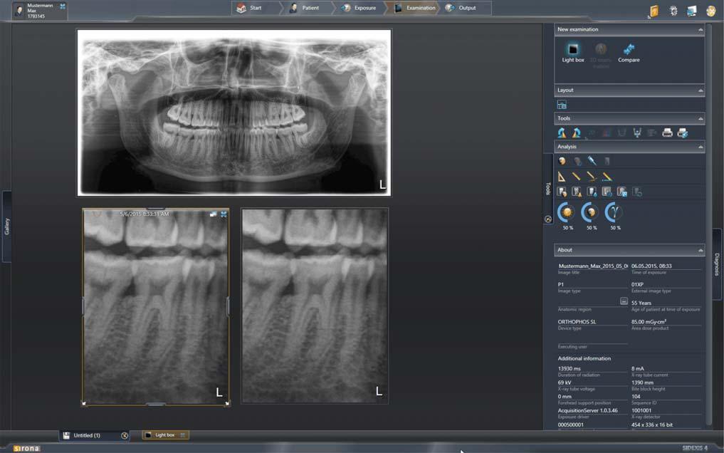 Sirona Dental Systems GmbH "SIDEXIS 4 kullanıcısı elkitabına" ek SIDEXIS 4 3 Panoramaeditor'ü kumanda edin 3.4 Panoramaeditor'ü kapatın / görünümleri kaydedin 3.