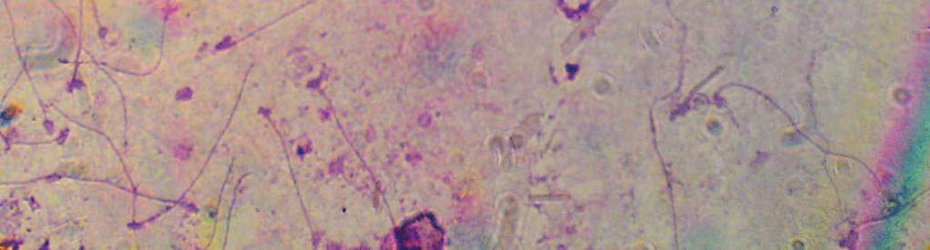 mikroskop altındaki görüntüsü ekil 3.