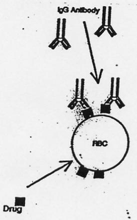 Hemolitik anemiden sorumlu antikor IgG antikorudur, IgM antikorundan daha az sıklıkla ve penisilinin benzilpenisilloil ve non-benzilpenisilloil determinantlarına karşı oluşur (Dacia 1967).