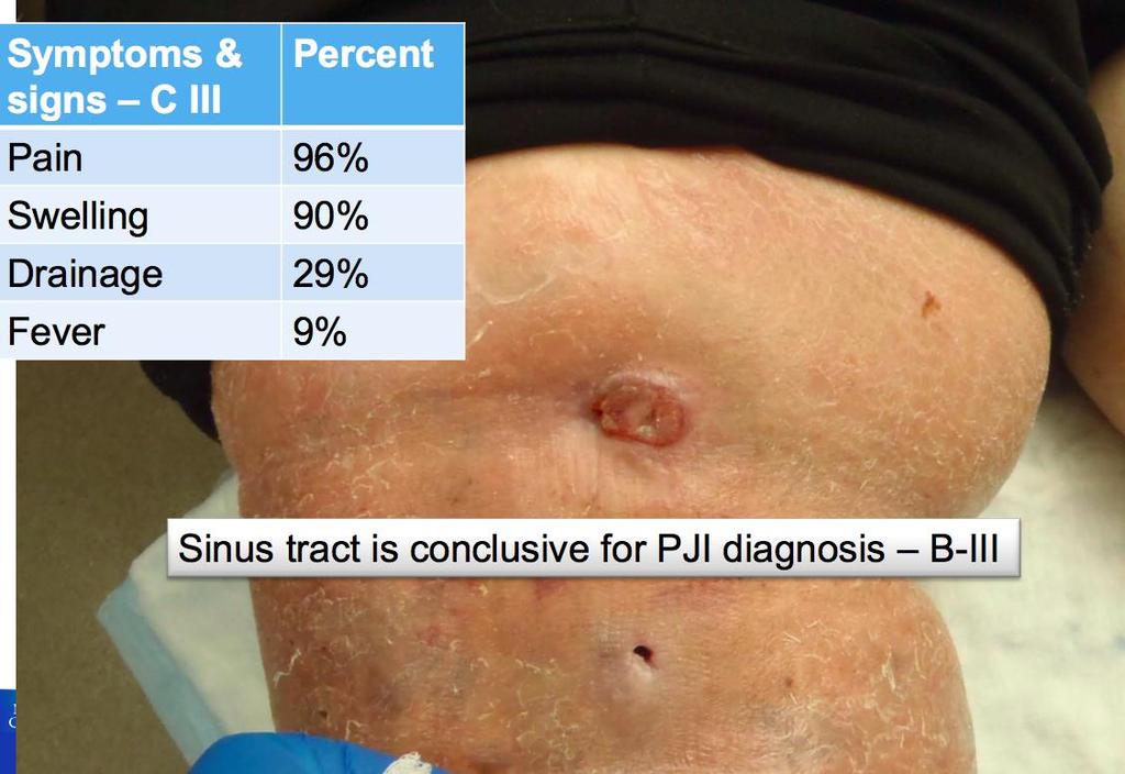 Semptom ve Bulgular: