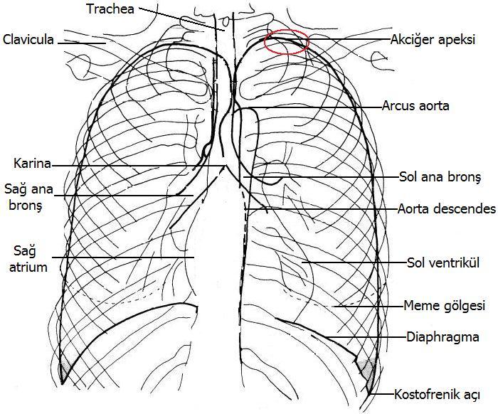 Radyografisinde Anatomik Yapı