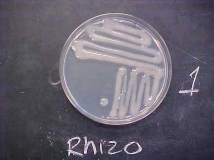 3. MATERYAL ve METOT Kemal DOĞAN Şekil 3.8. Petri kabı içerisinde üretilmiş Rhizobium bakterileri 3.2.3. Deneme Süresince ve Sonrası Yapılan Ölçüm ve Analizler Daha önce belirtilen deneme öncesi