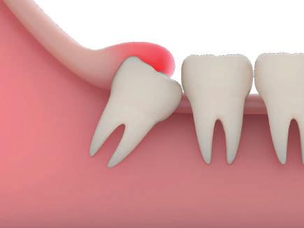 Diş çekimi dışındaki cerrahi tedaviler (kist çıkarılması, gömülü diş çekimi, kök ucu rezeksiyonu, eklem cerrahisi, çene kırığı tedavisi ve diğer büyük ameliyatlar) için size hasta onam formu