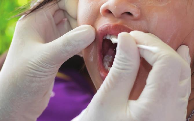 KORUYUCU TEDAVİLER Florür Uygulaması Koruyucu tedaviler diş çürüğü ve dişeti hastalıklarının oluşmasını önleyen işlemlerdir.