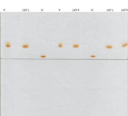 62 Tütsülenmiş kültür somonunun (TKS-6-7) içerdiği karotenoid çeşitleri şekil 4.15.