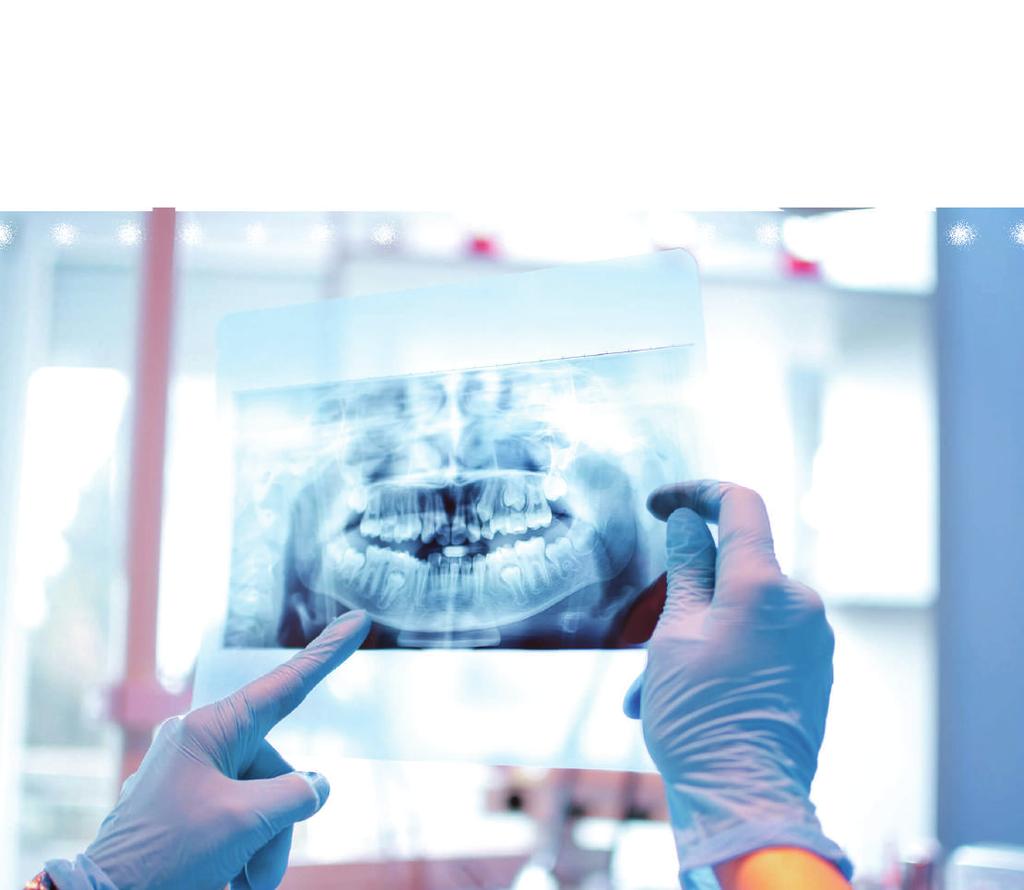 RADYOGRAFİ ÇEKİMİ Tedavi başlangıcında, tedavi süresince ve kontrol amaçlı olarak tedavi sonrasında diş ve çevre dokuların ayrıntılı olarak incelenebilmesi için radyograf çekilmesi gerekebilir.