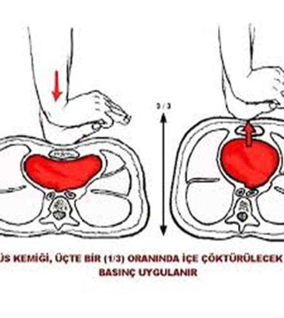 Göğüs basısı Bası