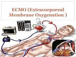 Alternatif teknikler ECPR-ECMO Seçilmiş hasta gruplarında (komorbiditesi olmayan, geri dönüşlü problemleri olan, ilaç overdozlarında, nabızsız