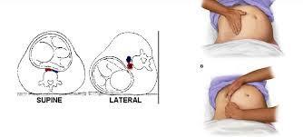 Maternal arrestin ilk 4